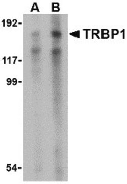 Anti-TRBP1 antibody produced in rabbit affinity isolated antibody