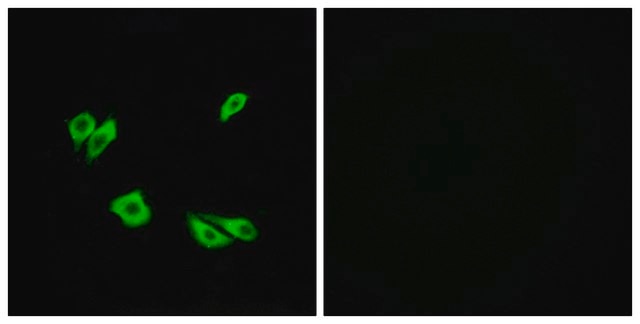 Anti-DAB1 antibody produced in rabbit affinity isolated antibody