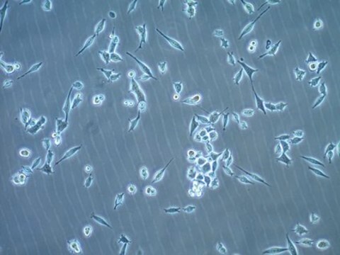 MB49 Mouse Bladder Carcinoma Cell Line MB49 mouse urothelial carcinoma cell line is widely used as an in vitro and in vivo model of bladder cancer.