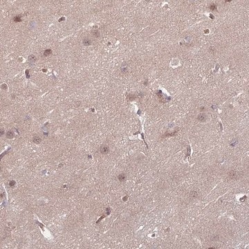 Anti-DAAM2 antibody produced in rabbit Prestige Antibodies&#174; Powered by Atlas Antibodies, affinity isolated antibody, buffered aqueous glycerol solution