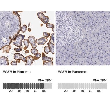 Anti-EGFR antibody produced in rabbit Ab1, Prestige Antibodies&#174; Powered by Atlas Antibodies, affinity isolated antibody, buffered aqueous glycerol solution