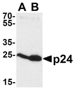 Anti-HIV-1 p24 antibody produced in rabbit affinity isolated antibody