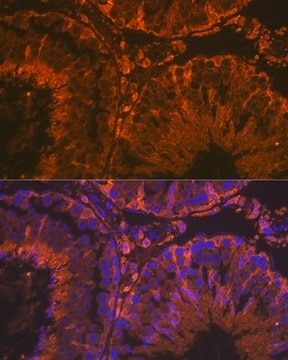 Anti-SRD5A2 antibody produced in rabbit