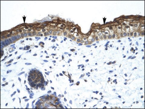 Anti-SMARCA2 antibody produced in rabbit affinity isolated antibody