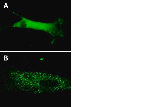 LentiBrite GFP-p62 Lentiviral Biosensor