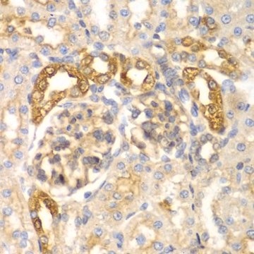 Anti-ASC/TMS1 antibody produced in rabbit