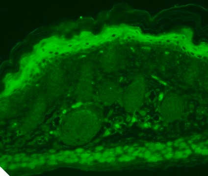 Monoclonal Anti-TRPV3 antibody produced in mouse clone S15-4, 1&#160;mg/mL, purified immunoglobulin