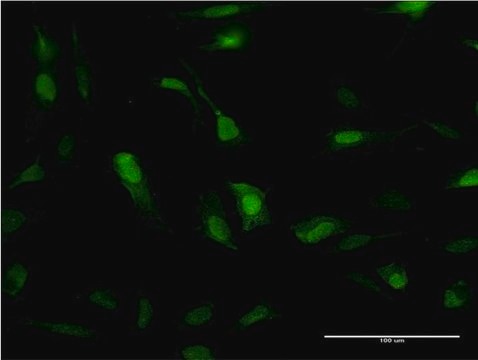 Monoclonal Anti-SOD1 antibody produced in mouse clone 10D5, purified immunoglobulin, buffered aqueous solution