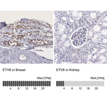 Anti-ETV6 antibody produced in rabbit Prestige Antibodies&#174; Powered by Atlas Antibodies, affinity isolated antibody, buffered aqueous glycerol solution