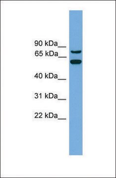 Anti-YY1AP1 antibody produced in rabbit affinity isolated antibody