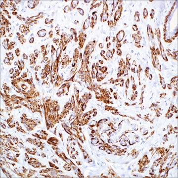 Myosin, Smooth Muscle (SMMS-1) Mouse Monoclonal Antibody