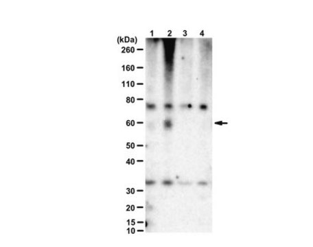 Anti-phospho-CaMKII beta (Ser331) from rabbit, purified by affinity chromatography