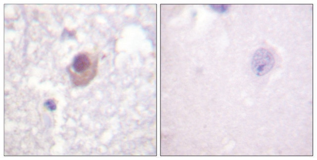 Anti-SGK antibody produced in rabbit affinity isolated antibody