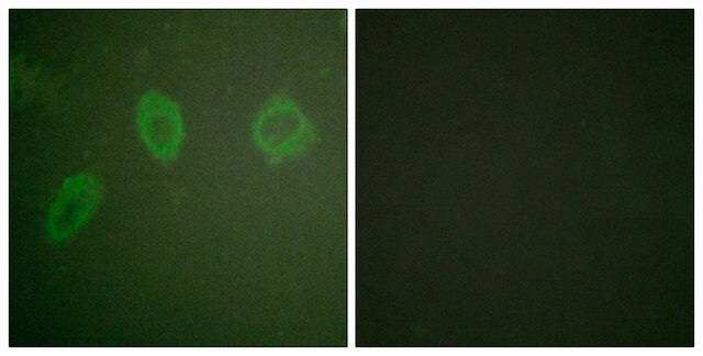 Anti-HER2 antibody produced in rabbit affinity isolated antibody