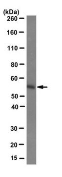 Anti-Estrogen Receptor &#946; Antibody, clone 9.88 clone 9.88, from mouse