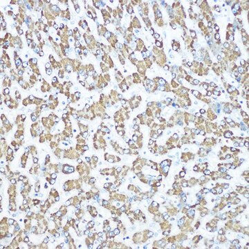 Anti-CPS1 antibody produced in rabbit