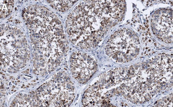 Anti-G3BP1 Antibody, clone 1B10 ZooMAb&#174; Rabbit Monoclonal recombinant, expressed in HEK 293 cells