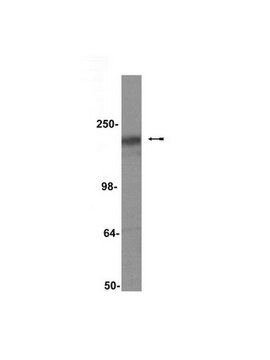 Anti-CFTR Antibody, clone M3A7 clone M3A7, Upstate&#174;, from mouse