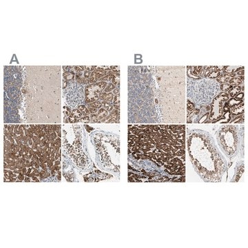 Anti-ACAT1 antibody produced in rabbit Prestige Antibodies&#174; Powered by Atlas Antibodies, affinity isolated antibody, buffered aqueous glycerol solution