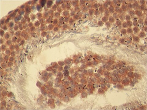 Anti-Rictor antibody produced in rabbit ~1-2&#160;&#956;g/mL, affinity isolated antibody