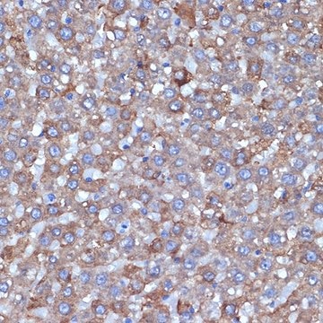 Anti-ALDH1L1 antibody produced in rabbit