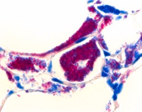 AFB-Color staining kit for the microscopic investigation of acid-fast bacteria (cold staining)