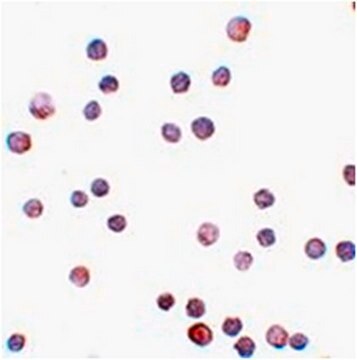 Anti-ZEB1 Antibody from rabbit, purified by affinity chromatography