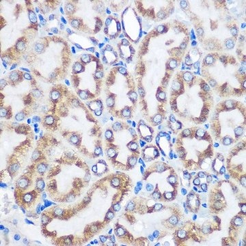 Anti-LOX antibody produced in rabbit