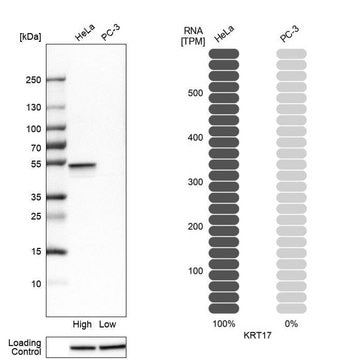 Anti-KRT17 antibody produced in rabbit Ab1, Prestige Antibodies&#174; Powered by Atlas Antibodies, affinity isolated antibody, buffered aqueous glycerol solution