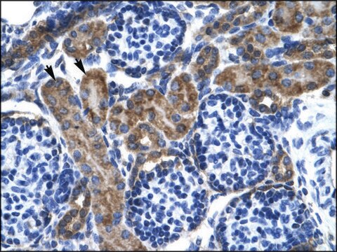 Anti-KCNQ2 antibody produced in rabbit IgG fraction of antiserum