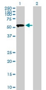 Anti-SASS6 antibody produced in mouse purified immunoglobulin, buffered aqueous solution