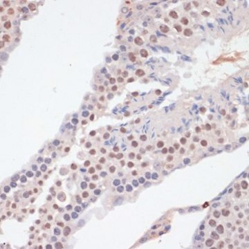 Anti-Phospho-NF-kB p65-S536 antibody produced in rabbit