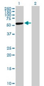 Anti-CBS antibody produced in mouse purified immunoglobulin, buffered aqueous solution