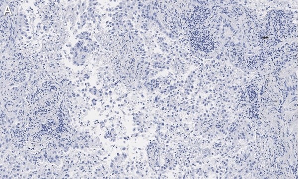 Anti-Integrin &#945;V&#946;5 Antibody, clone EM09902 , ZooMAb&#174; Rabbit Monoclonal recombinant, expressed in HEK 293 cells