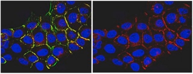 Anti-Pan-Ras Antibody, clone RAS 10 clone RAS 10, from mouse