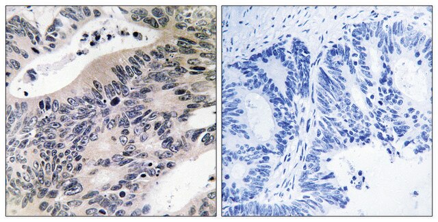 Anti-ACSS1 antibody produced in rabbit affinity isolated antibody