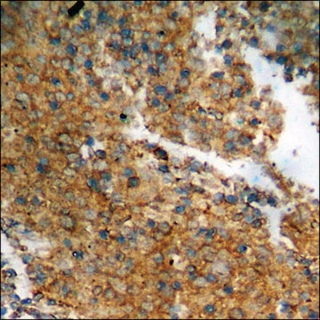 Anti-phospho-Catenin-&#946; (pThr41/Ser45) antibody produced in rabbit affinity isolated antibody