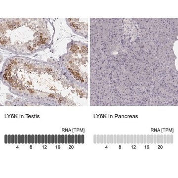 Anti-LY6K antibody produced in rabbit Prestige Antibodies&#174; Powered by Atlas Antibodies, affinity isolated antibody, buffered aqueous glycerol solution