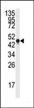 ANTI-NSE (Y236) antibody produced in rabbit affinity isolated antibody, buffered aqueous solution