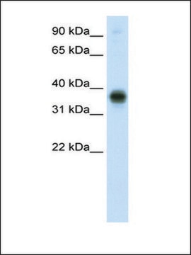 Anti-E2F3 antibody produced in rabbit affinity isolated antibody