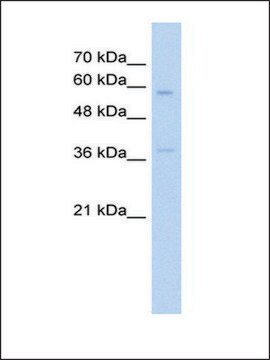 Anti-ITGBL1 (AB2) antibody produced in rabbit IgG fraction of antiserum