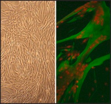 Human Skeletal Muscle Cells: HSkMC, adult