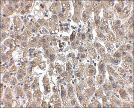 Anti-LDL-R antibody produced in chicken affinity isolated antibody, buffered aqueous solution