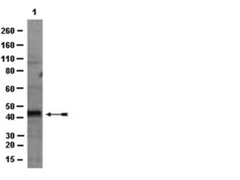 Anti-HDAC11 Antibody from rabbit