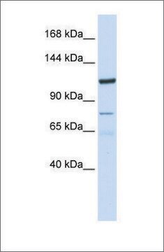 Anti-KIAA1324 antibody produced in rabbit affinity isolated antibody