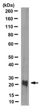 Anti-Retinoschisin Antibody, clone 3R10 clone 3R10, from mouse