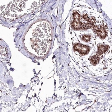 Anti-DMP1 antibody produced in rabbit Prestige Antibodies&#174; Powered by Atlas Antibodies, affinity isolated antibody, buffered aqueous glycerol solution