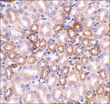 Anti-Nephrin antibody produced in rabbit affinity isolated antibody, buffered aqueous solution