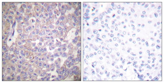 Anti-Claudin 2 antibody produced in rabbit affinity isolated antibody