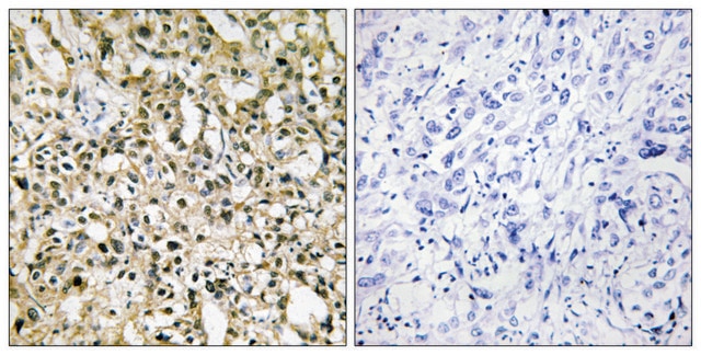 Anti-MYC antibody produced in rabbit affinity isolated antibody